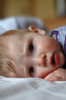 fifth disease baby